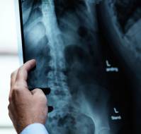 X Ray Imaging Tests For Clinical Diagnosis