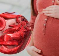 Iron, Folic Acid, and Vitamin B12 Supplementation for Anemic Pregnant Women