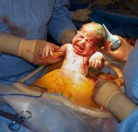 A glimpse into bladder injuries during emergency cesarean deliveries