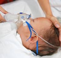 Effectiveness of nirsevimab in infants with acute respiratory infections