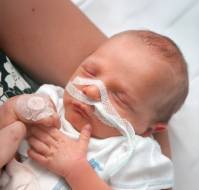 Refractory respiratory distress syndrome risk factors in newborns with very low birth weights