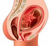 A Case Report of Successful Management of Central Placenta Previa