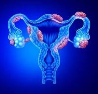 A Case Study establishing the Importance of Routine Screening for Ovarian Cancer