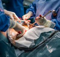 Surgical Approach to Mitigate the Risks of Complications in Cesarean Section