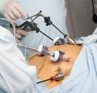 Optimal Time Interval from Myomectomy for Better Pregnancy Outcomes
