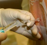 Intrathecal Bupivacaine with Buprenorphine Confers Prolonged Analgesia During C-Sections