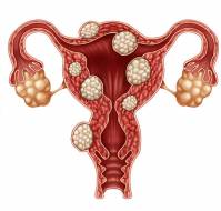Rare Benign Tumors of the Vulva: Clinical Insights from a Case Series