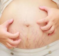 Pregnancy and the Skin: Unraveling Dermatological Impacts