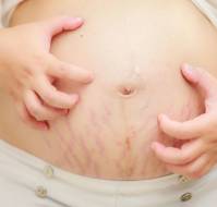 Managing Dermatoses in Pregnancy: Evidence-Based Therapeutic Insights