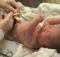 Alcohol-Based Chlorhexidine May Lower Infection Risk in Preterm Neonates