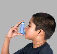Long-term Outcomes of Severe Childhood Asthma