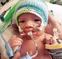 Cobra Bite Mimicking Brain Death in a 2-Year-Old