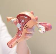 Endometrial Ablation and Subsequent Hysterectomy Risk in Women with Abnormal Uterine Bleeding