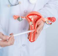 Placenta Previa with Uterine Body Accreta Spectrum in Post-Uterine Artery Embolization Pregnancy