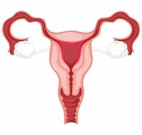 Accessory Cavitated Uterine Mass: A case of variant Mullerian Anomaly