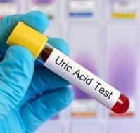 Abnormal Uric Acid Levels and Gestational Diabetes Mellitus: Is There a Link?