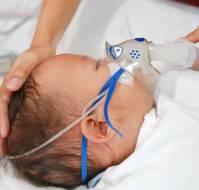 Epidemiological Analysis of Viral Pathogens Associated with Lower Respiratory Tract Infections in Children