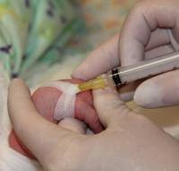 Cryo-Analgesia for Intravenous Cannulation in Children