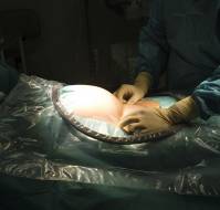 Unsupervised Medical Termination Revealing a Heterotopic Pregnancy: A Clinical and Surgical Challenge