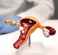  Peer Networks Drive Physician Adoption of Opportunistic Salpingectomy