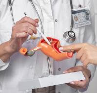 RA vs TFA in Uterine Artery Embolization: Systematic Review Highlights Safety and Efficiency