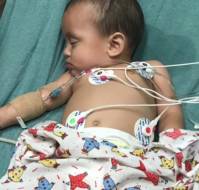 Hemodynamic Management in Pediatric Septic Shock