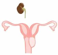 A Rare Case of Ohvira Syndrome