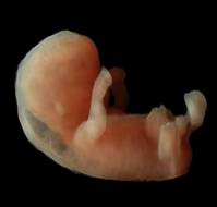 Re-evaluating Nuchal Translucency Cut-offs in First-Trimester Screening