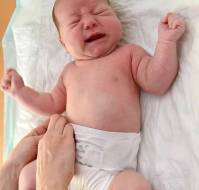 A Rare Cause of Acute Urinary Retention in a 7-Month-Old Infant