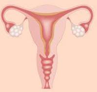 A Rare case of Dual Ovarian Pathologies