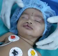 Accuracy of Advanced Pediatric Life Support Intubation Depth Formula in Indian Children 