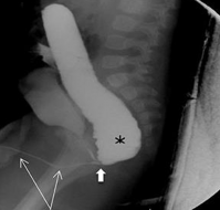 Male anorectal malformations: presurgical radiologic imaging objective and evaluation