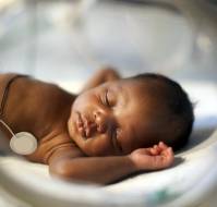 Evaluation of Pulse Rate, Oxygen Saturation, and Respiratory Effort after Different Types of Feeding Methods in Preterm Newborns