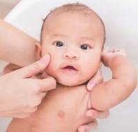 Frequent Versus Infrequent Bathing in Pediatric Atopic Dermatitis