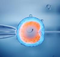 Fresh V/s frozen sperm for frozen donor egg IVF