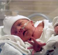 Growth, neurodevelopmental and health outcomes after extremely preterm birth.