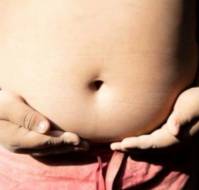 Health Burden Due to the Surge in Childhood Obesity in India
