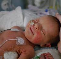 Invasive Bacterial Infections incidence rates in Preterm Infants