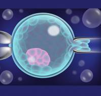 Live Birth with or without Preimplantation Genetic Testing for Aneuploidy