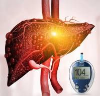 Diabetes and Chronic Liver Disease