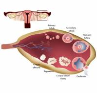 Luteal Phase Defect (LPD): A necessary tool in assisted reproductive techniques