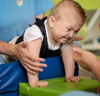Malnutrition and nutritional deficiencies in children with cerebral palsy