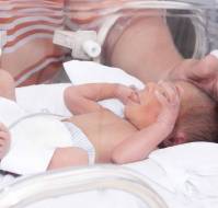 Neonatal Morbidities in Infants Born Late Preterm at 35-36 Weeks of Gestation
