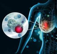 Predictive Biomarkers for Neoadjuvant Chemotherapy in Breast Cancer