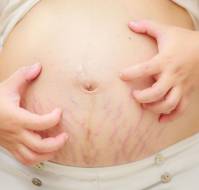 Pregnancy Specific Dermatoses and Skin Disease