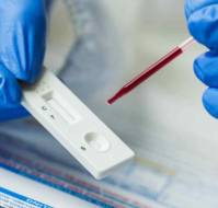 Rapid Antibody Detection Test for Scrub Typhus
