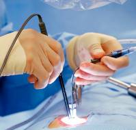 Which Laparoscopic Entry Technique is the Preferred Choice?