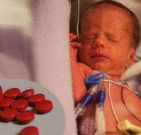 Iron and Neurodevelopment in Preterm Infants