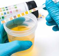 Rethinking Urine Culture Cutoffs for UTI Diagnosis in Young Children
