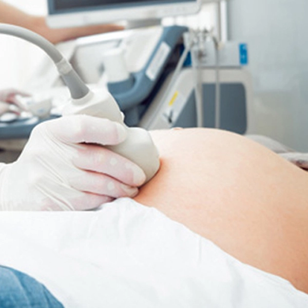 Function and Safety of SlowflowHD Ultrasound Doppler in Obstetrics